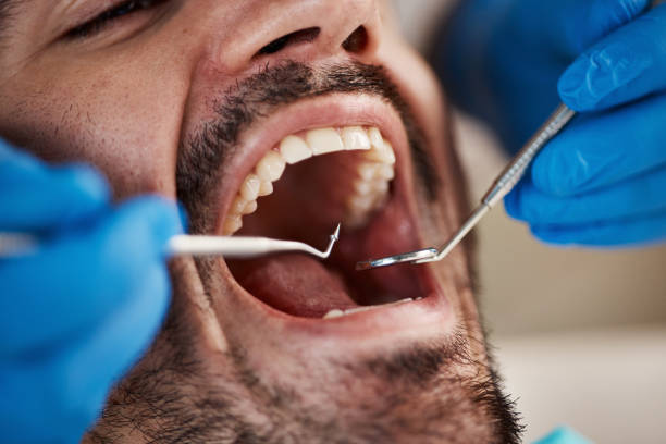 Best After-Hours Emergency Dentist in Lake Riverside, CA